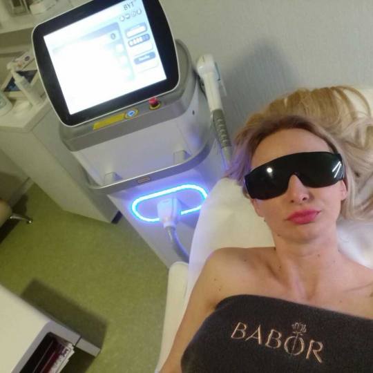 Ordinacija Epil Medic #beograd Laserska epilacija Laserska epilacija pazuha - za dame Laserska Epila