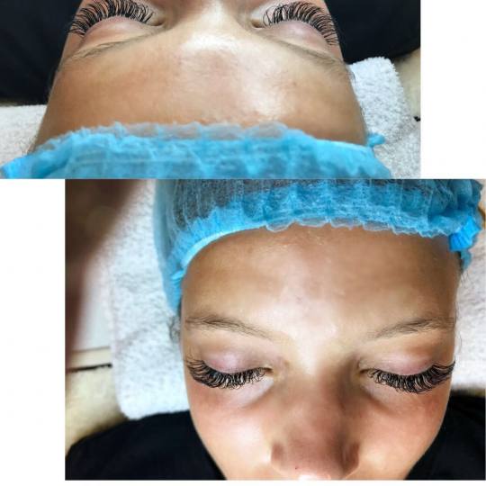 Estetic star by Maya #beograd