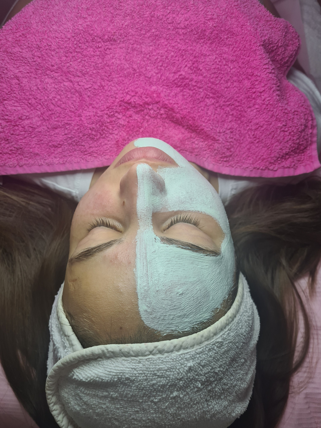 Starmedic #beograd Tretman lica Brabor klasičan tretman lica