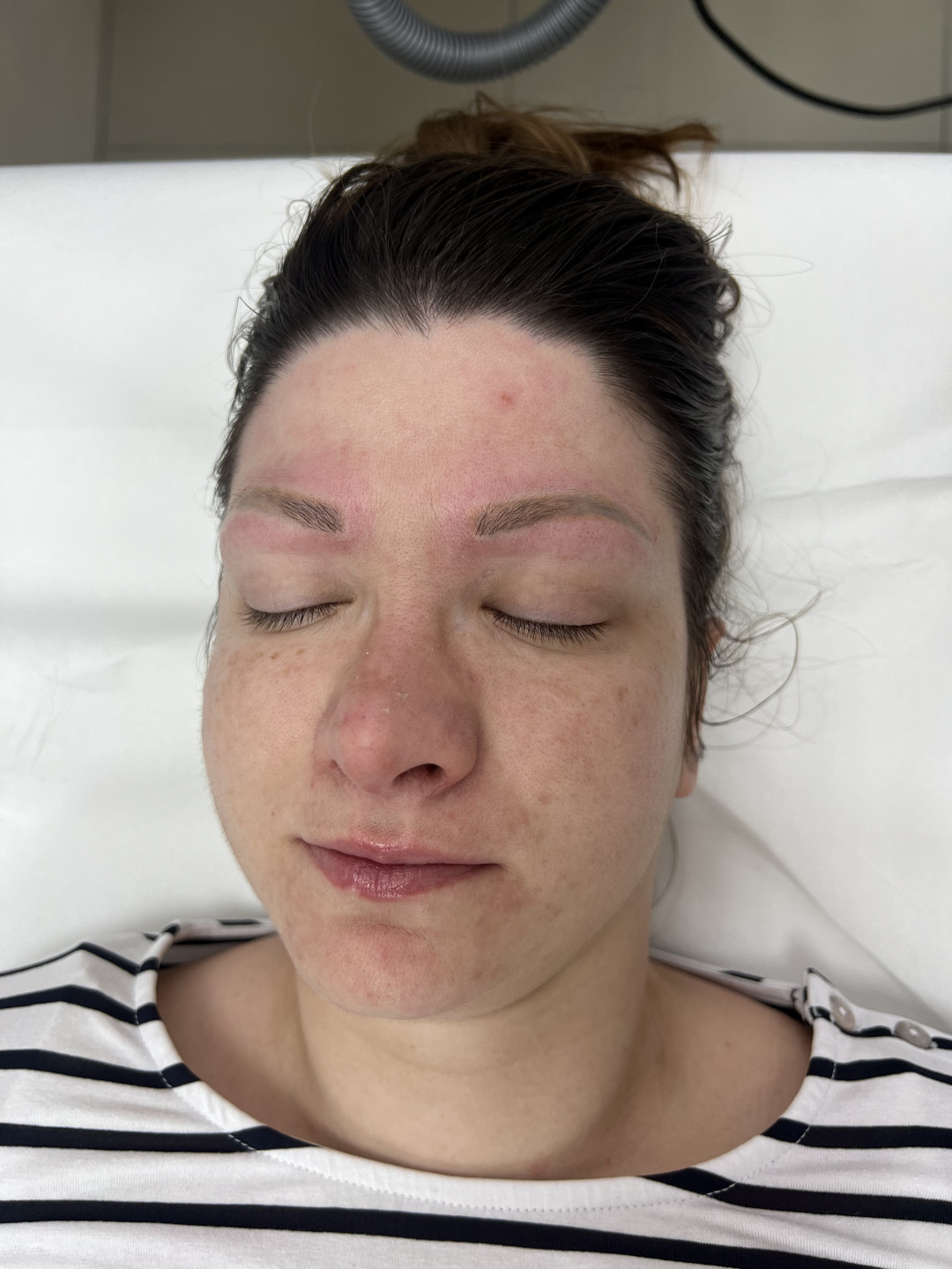 GM Beauty studio #beograd Uklanjanje tetovaža Lasersko uklanjanje tetovaže