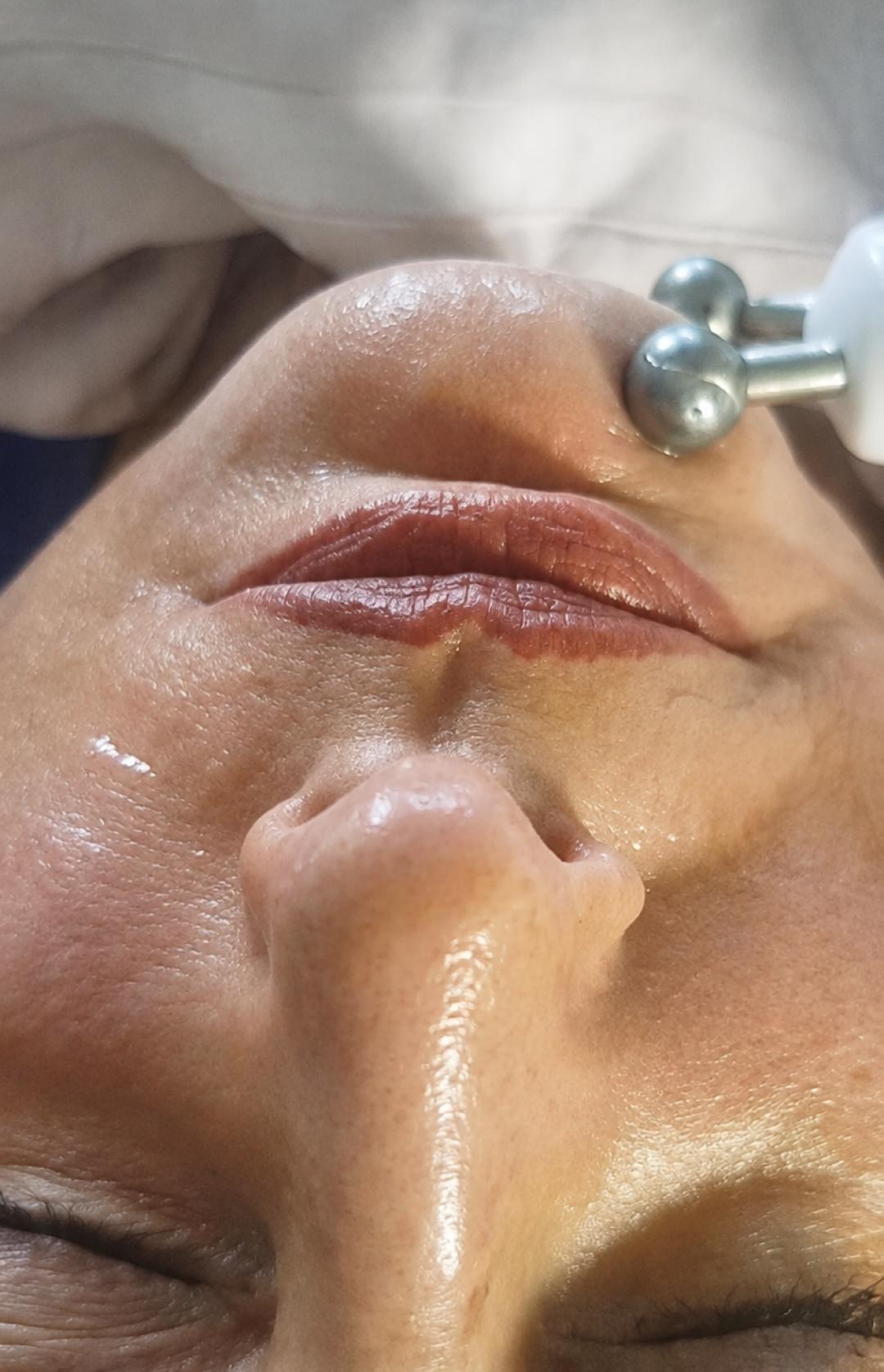 Professional beauty and spa #beograd Tretmani tela Akcija ultrazvucno ciscenje lifting i mezo