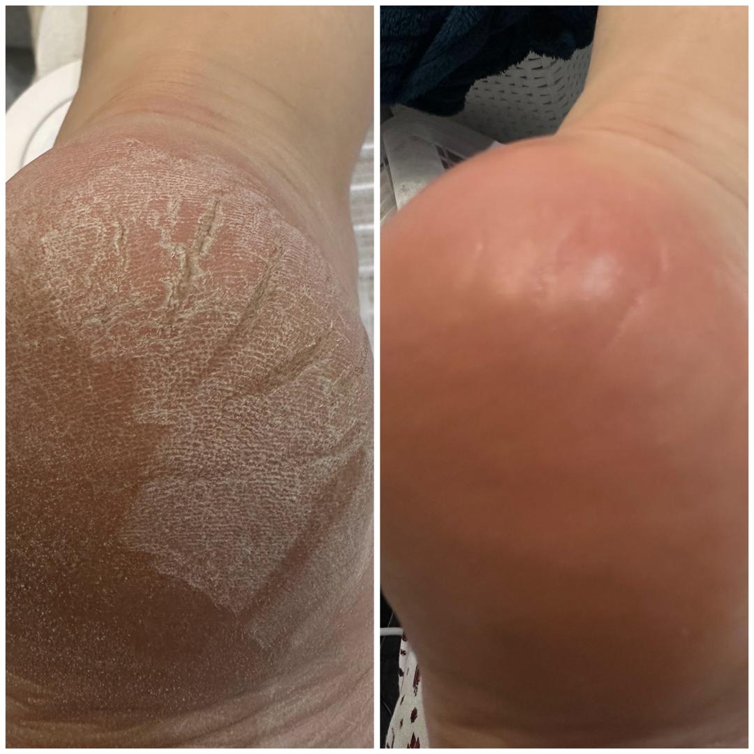 Ruski suvi pedikir - Petra beauty concept, Beograd Ruski manikir i pedikir Nokti Ruski manikir i pedikir, Beograd, Vračar, Čubura, Crveni krst