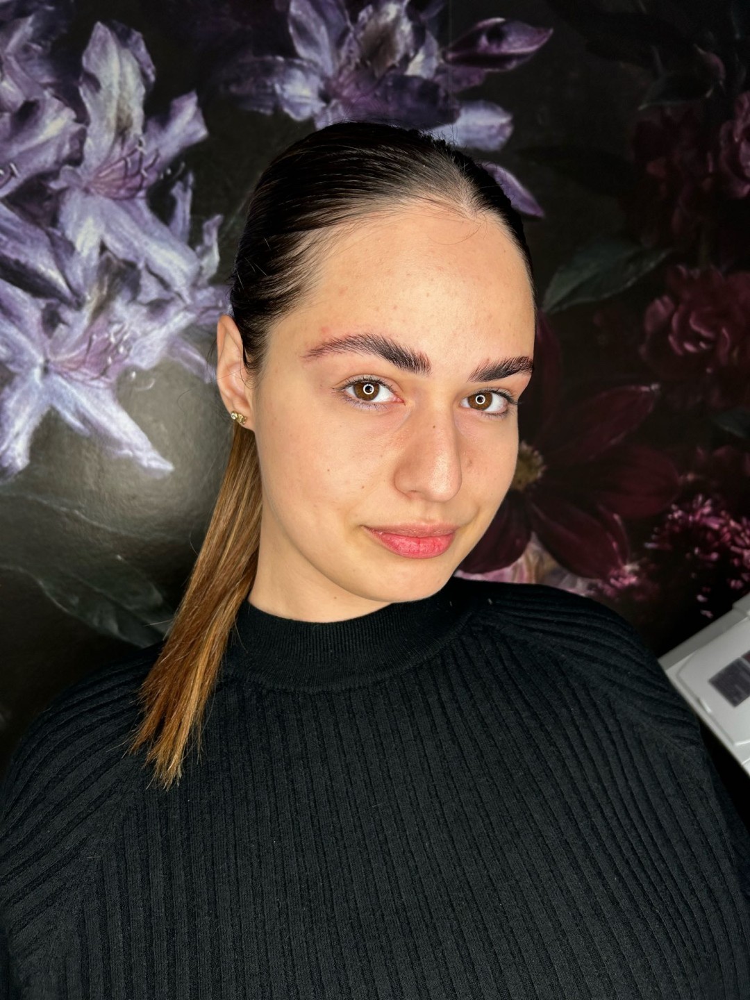 Brow lift - Studio Benvenuto, Beograd Obrve Lice Obrve, Beograd, Voždovac