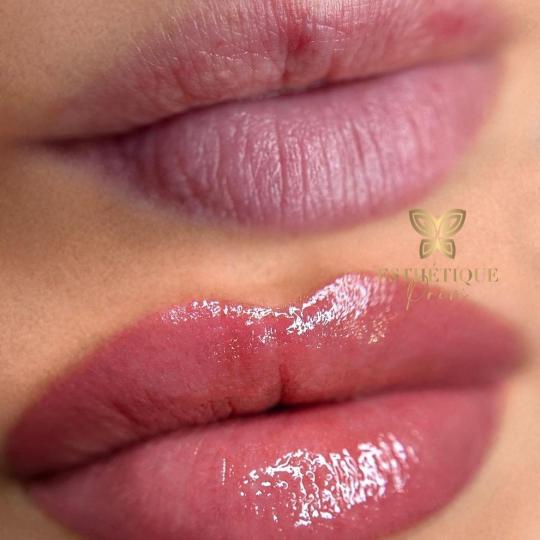 Esthetique Privé #beograd Trajna šminka Trajna šminka usana - PHI LIPPS