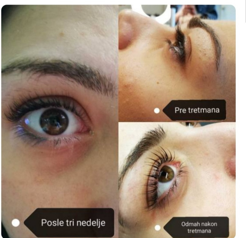 Be YOU tiful #novisad Trepavice Lash lifting + botox