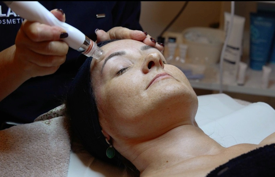 Beauty Koko Housse - Vračar #beograd Mikrodermoabrazija Mikrodermoabrazija lica + higijenski tretman lica+ gratis još jedna maska