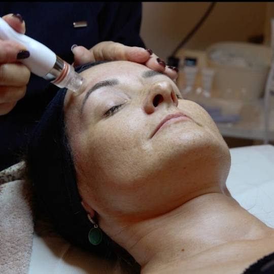 Beauty Koko Housse - Vračar #beograd Mikrodermoabrazija Mikrodermoabrazija lica + higijenski tretma
