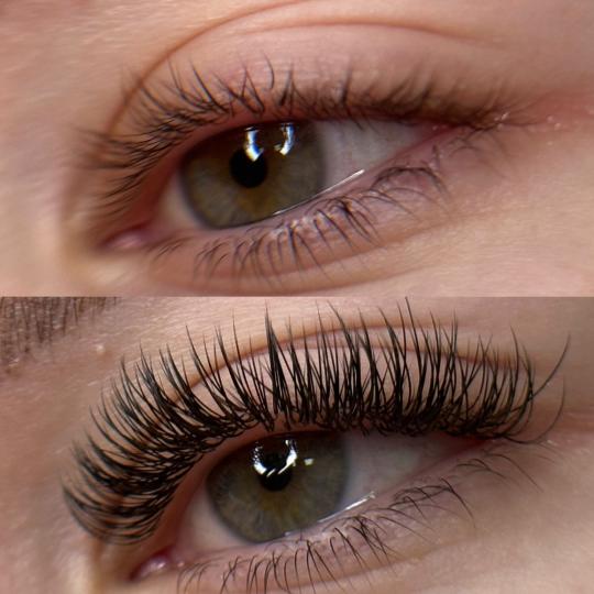 Estetic studio Ognjanović usluga