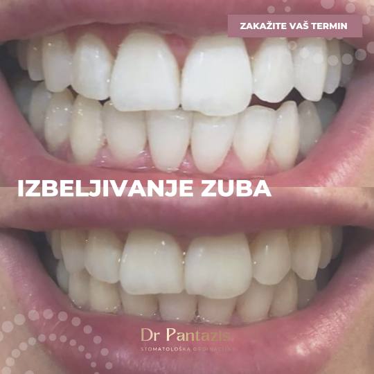Dr Pantazis - Dental & Beauty Clinic #beograd