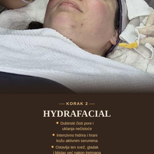 Oladoria Rituals #novisad Tretman lica Summer GLOW SKIN