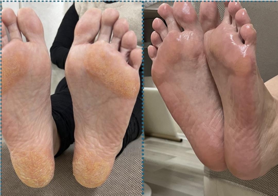 Amelini beauty concept #beograd Estetski pedikir Pedikir