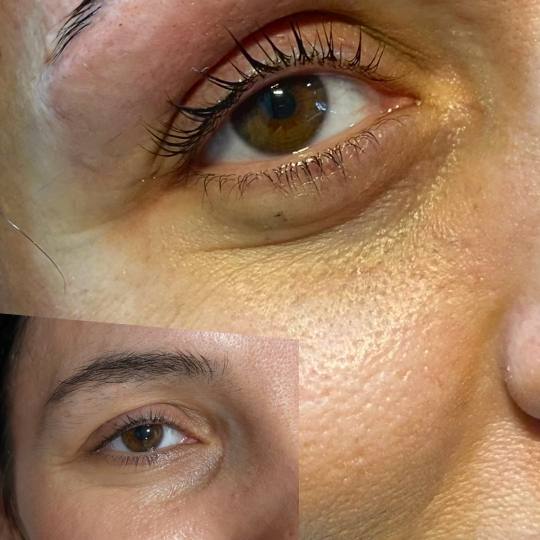 Fam Beauty Box #beograd Trepavice