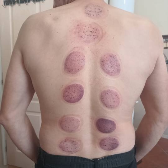 Relax body centar #zajecar Masaža teglama Mokra hidžama