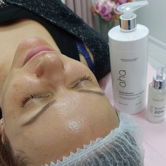 Andromeda Beauty Studio #beograd Tretman lica Higijenski tretman lica + mikrodermoabrazija