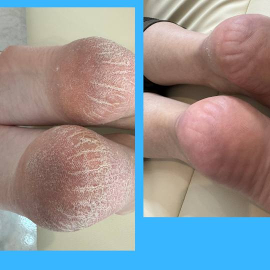 Dunja beauty 022 #novisad Estetski pedikir Estetski pedikir