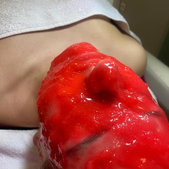 Angels #novisad Tretman lica Bioloski tretman lica sa lux maskom Vampire infusion Lice