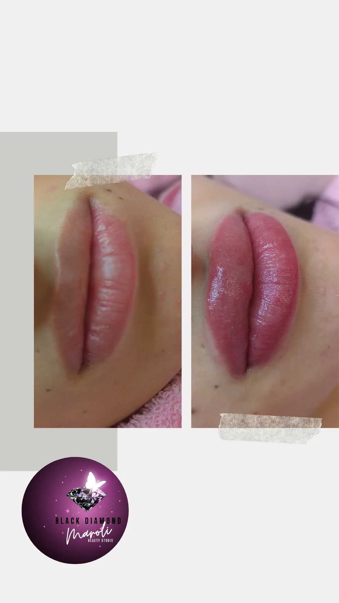 Labelo lips - trajna šminka usana - Black Diamond Maroli, Novi Sad Trajna šminka Lice Trajna šminka, Novi Sad, Centar - Stari grad