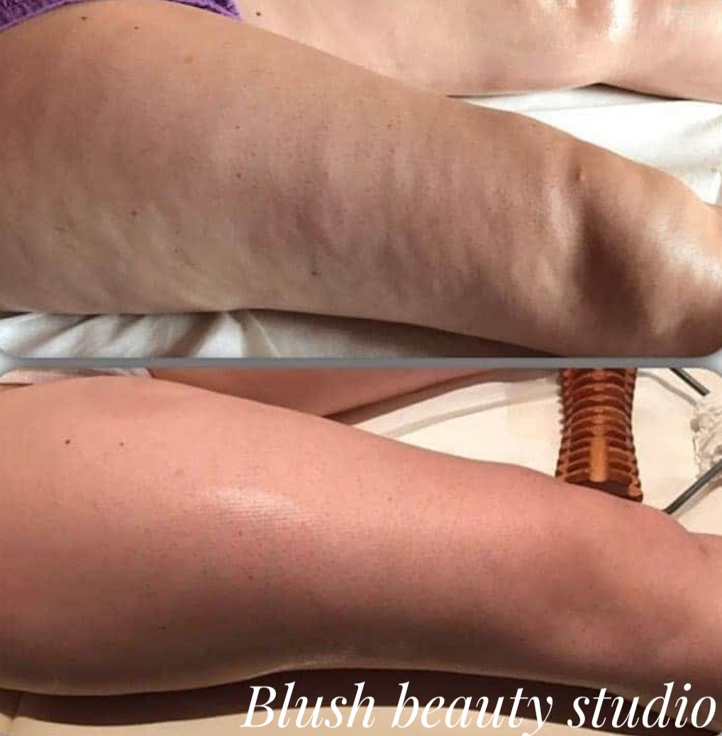 Blush Beauty Studio #beograd Anticelulit masaža Maderoterapija 45 minuta - paket od 10 tretmana