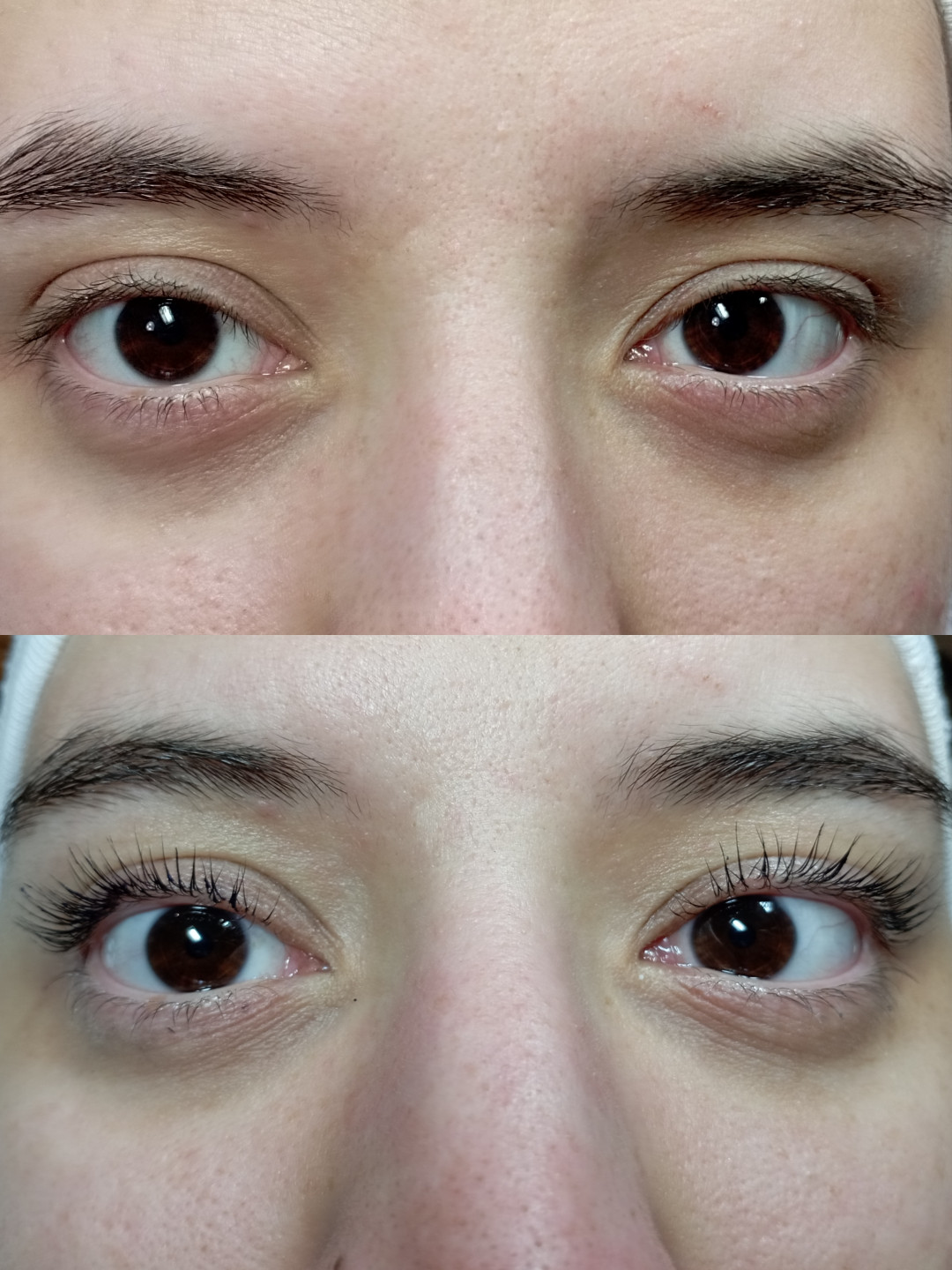 Factor Estetic #beograd Trepavice