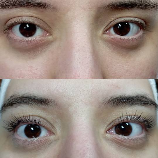 Factor Estetic #beograd Trepavice