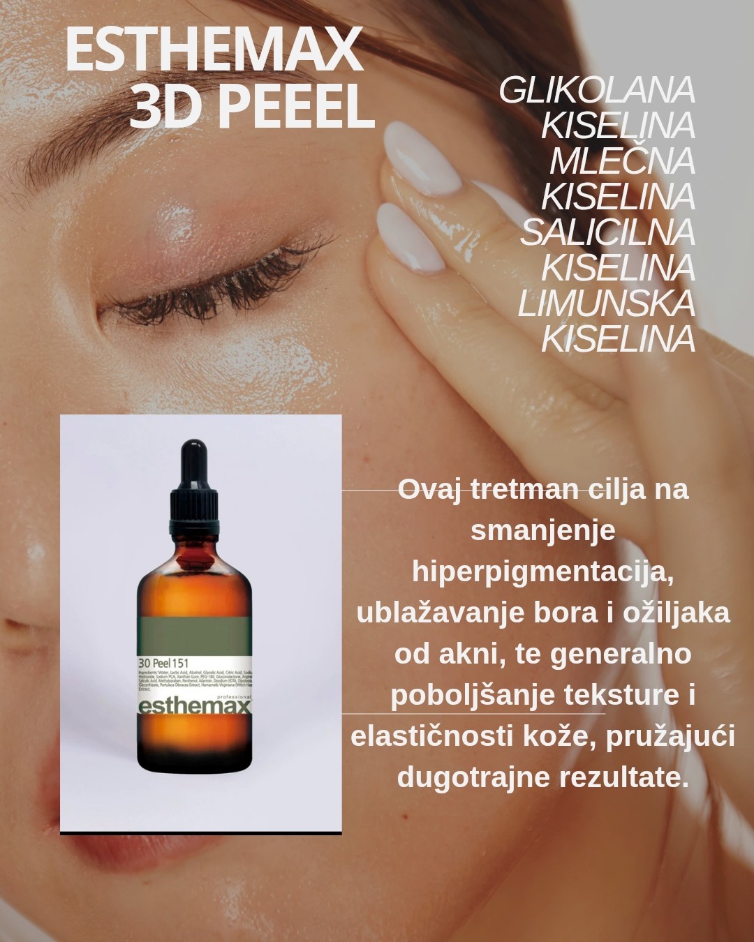 Nega lica i tela kod Gorice #beograd Tretman lica Esthemax hemijski piling