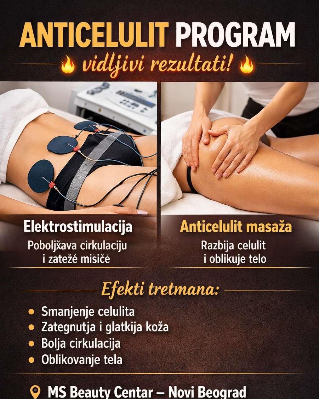 MS Beauty Centar #beograd