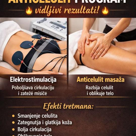 MS Beauty Centar #beograd