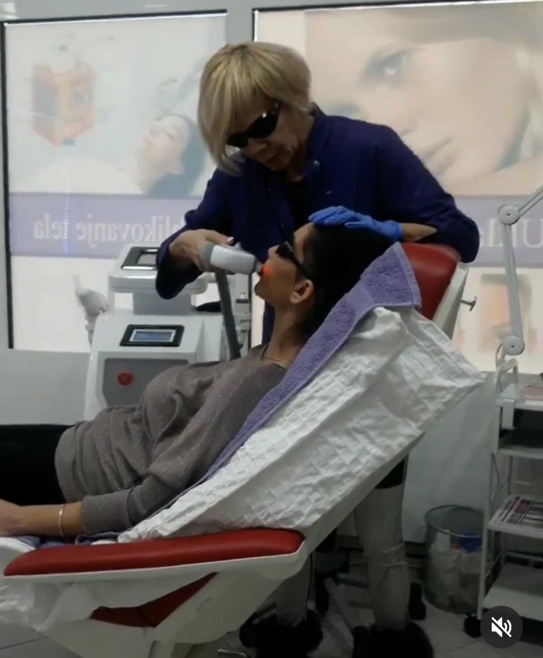 AltaBella Batajnica #beograd Laserska epilacija Laserska epilacija nausnica - za dame