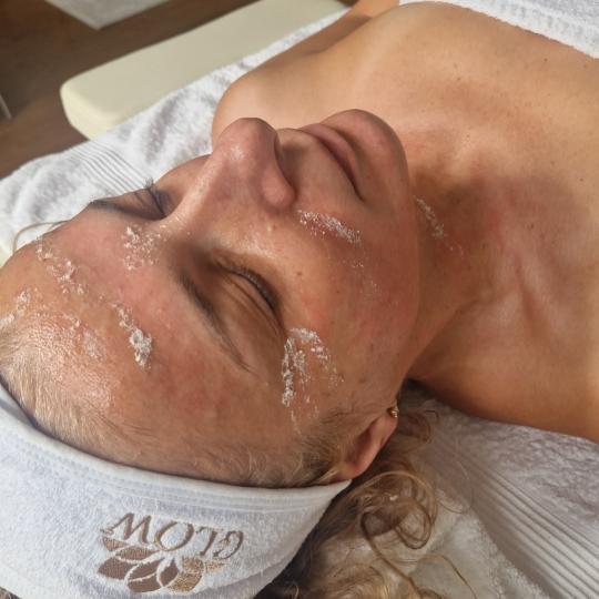 Glow Holistic Studio #beograd Dermaroler i dermapen Dermapen - lice + vrat + dekolte Sa dermapen apa