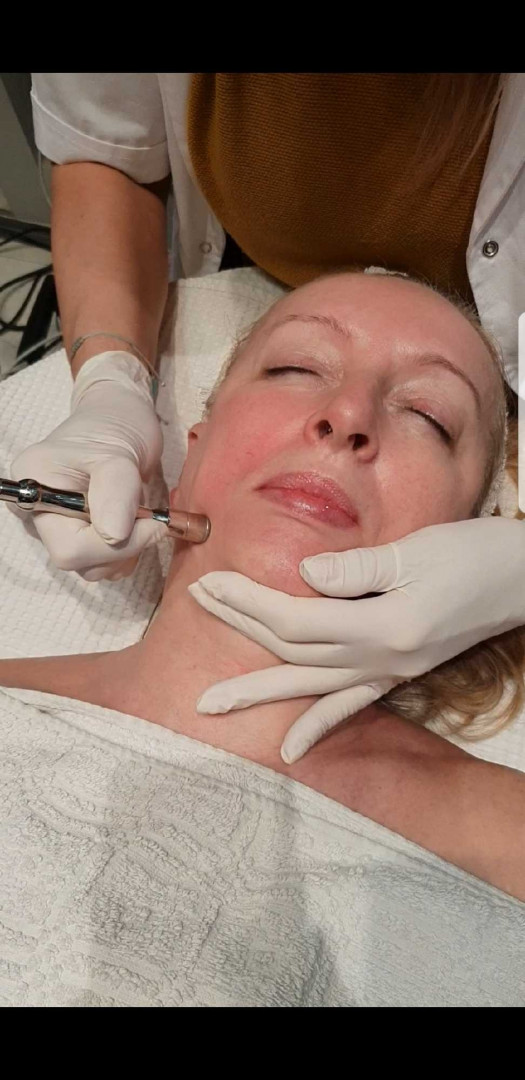 Grossi cosmetic #beograd Tretman lica