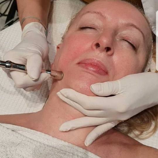 Grossi cosmetic #beograd Tretman lica