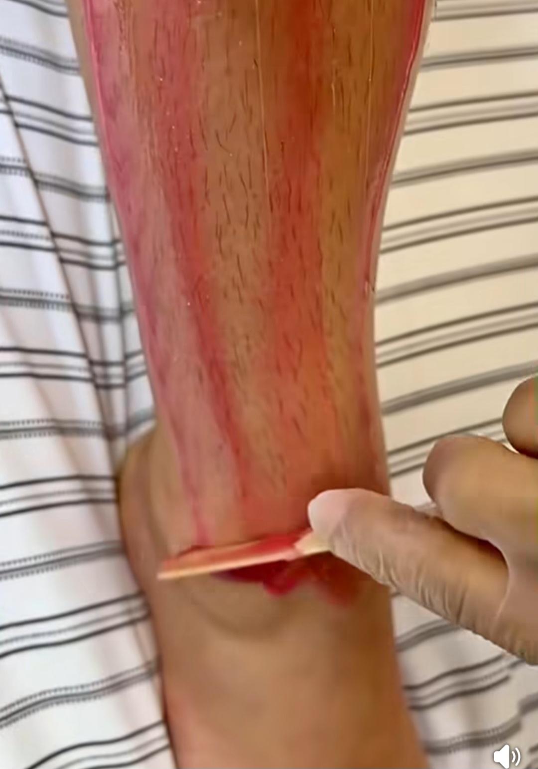 Beauty by Gordana 014 #beograd Depilacija nogu Depilacija pola nogu hladnim voskom - za dame