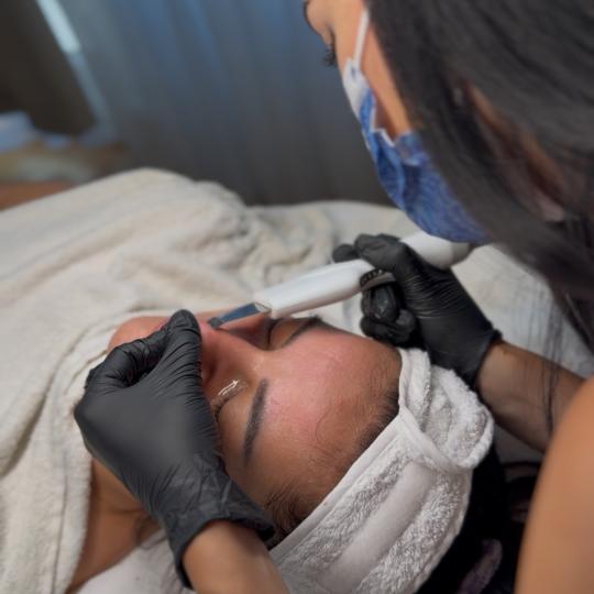 Evels Beauty #nis Tretman lica Enzimski piling + ultrazvučna špatula