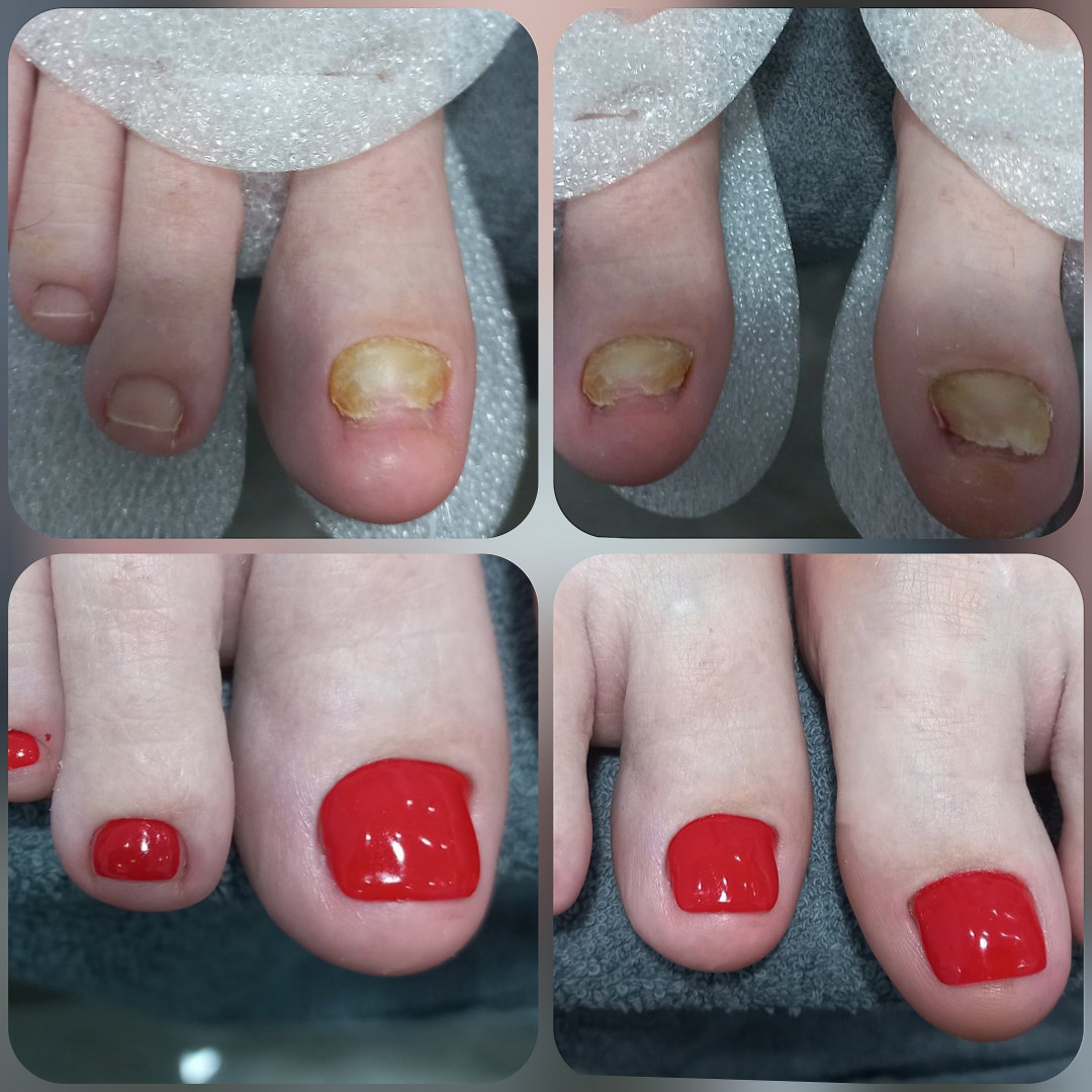 Beauty Palace by M #beograd Gel lak Pedikir + gel lak ( ruski pedikir )