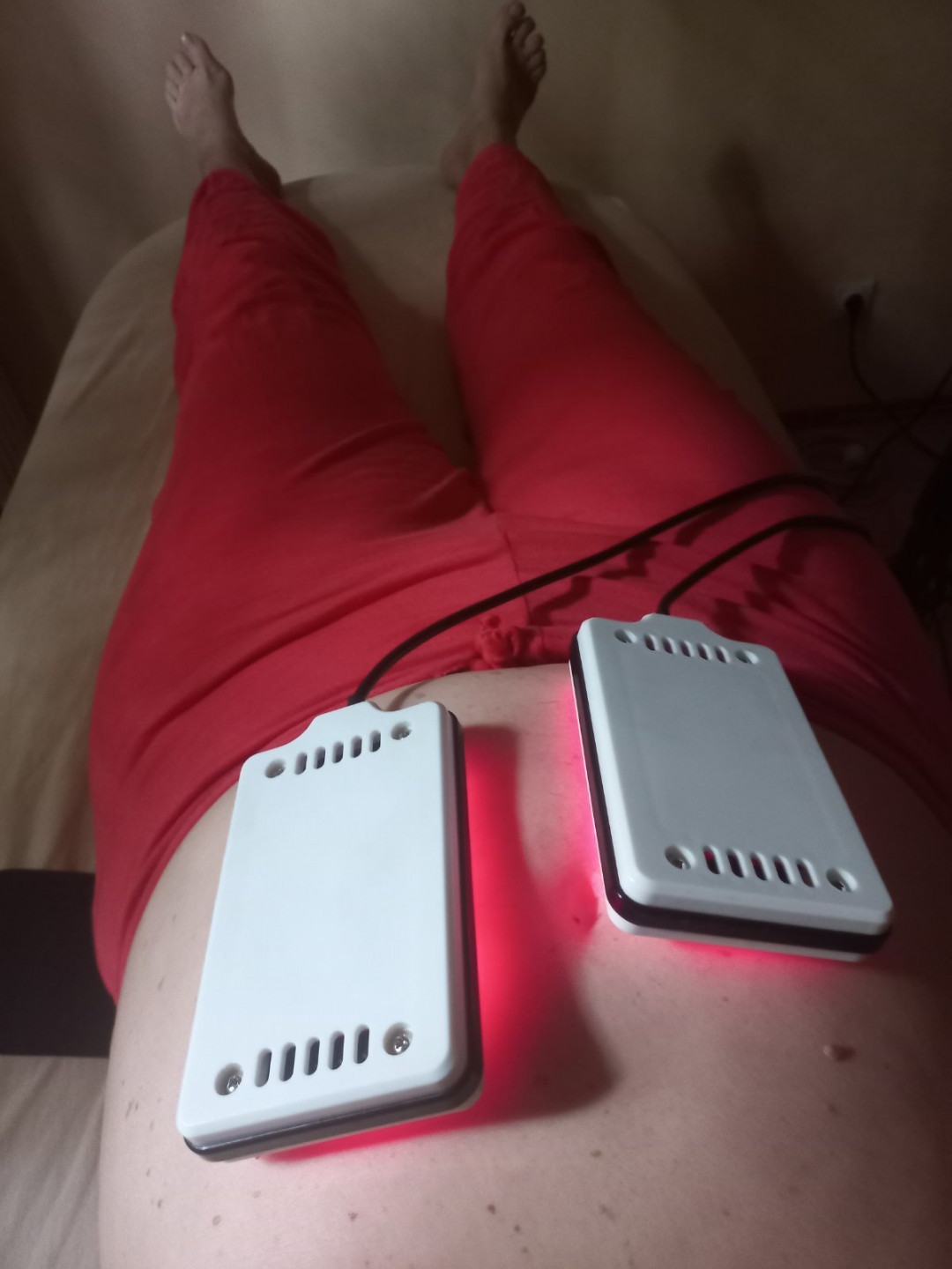 21 Beauty Centar #beograd Tretmani tela Paket 2 - ReShape x 5 + Lipo laseri x 5 + EMS x 5 + Ice Cryo Body x 2