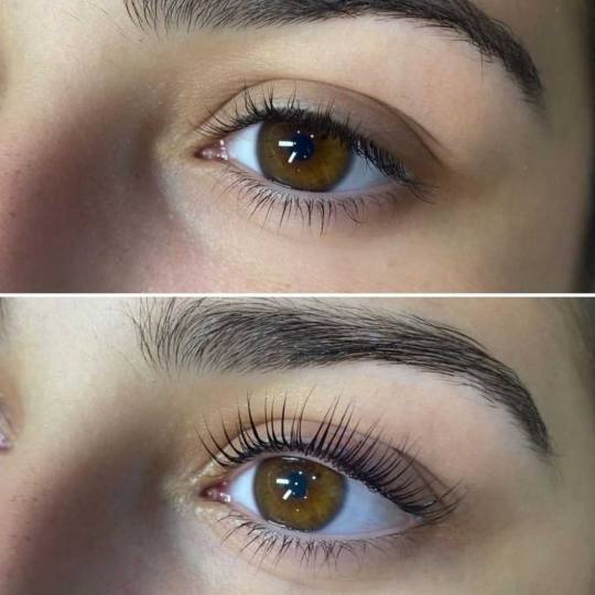 Right Beauty #beograd Trepavice Lash lift + farbanje + Botox