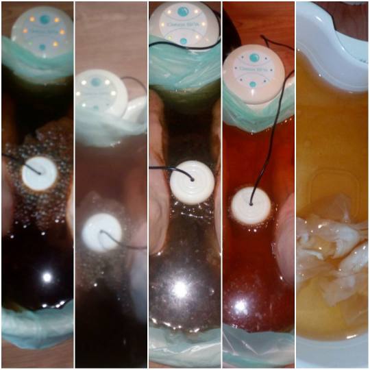 Migun centar relax #beograd SPA Aqua detox spa Aparat za ciscenje organizma,  preko pora na stopalim