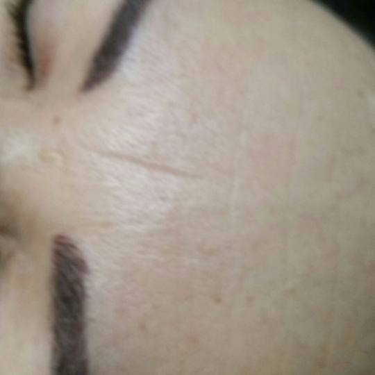 Inter esthetic academy #beograd