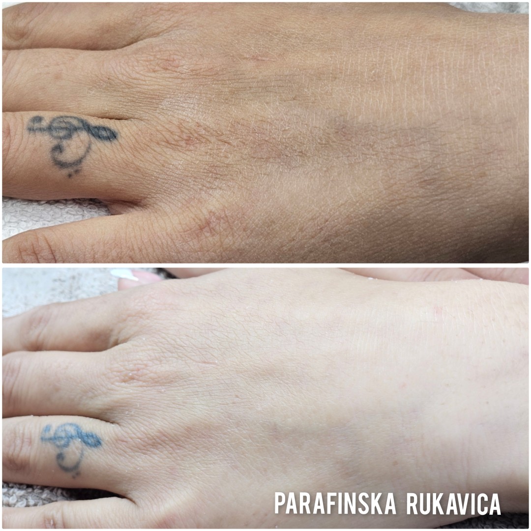 Beauty salon XL Lady #beograd Parafinska pakovanja Parafinsko pakovanje - ruke