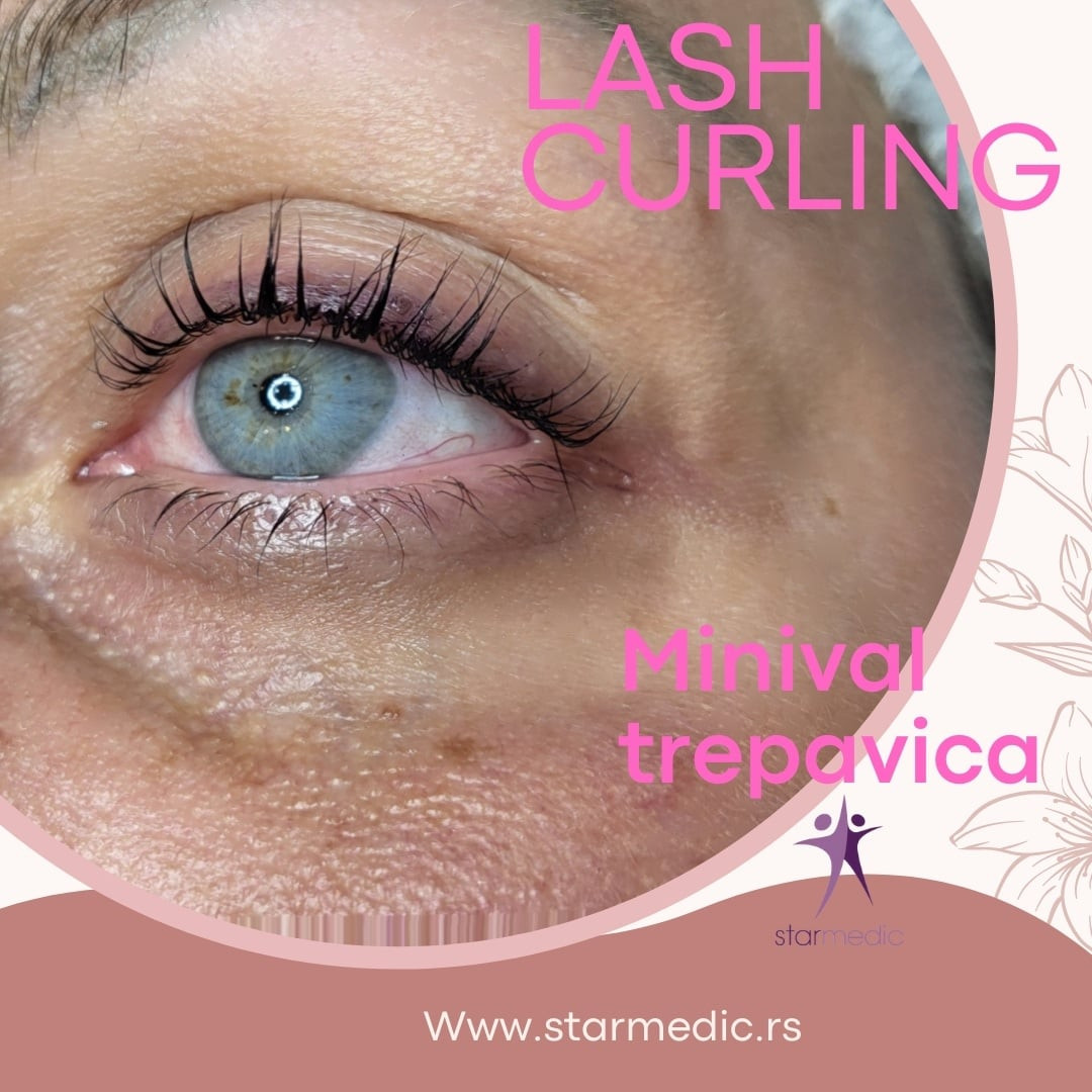 Starmedic #beograd Trepavice Minival trepavica + farbanje trepavica