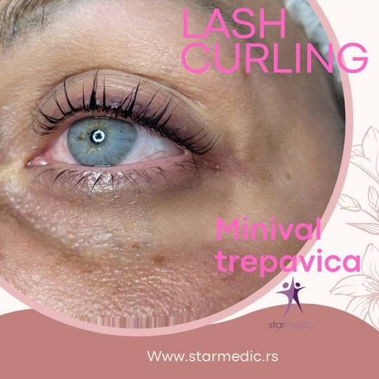 Starmedic #beograd Trepavice Minival trepavica + farbanje trepavica