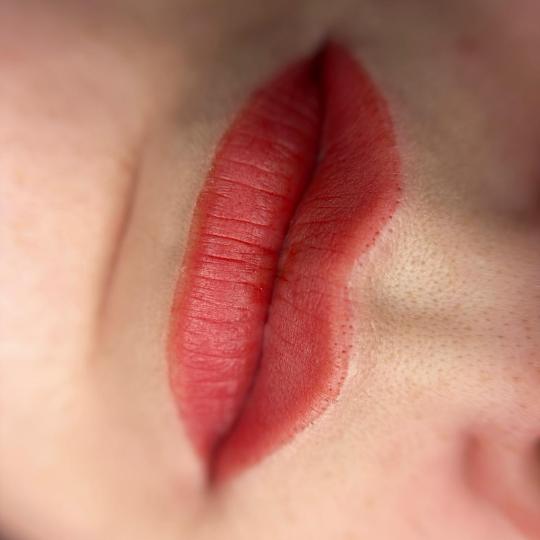 MiViDa Beauty System usluga