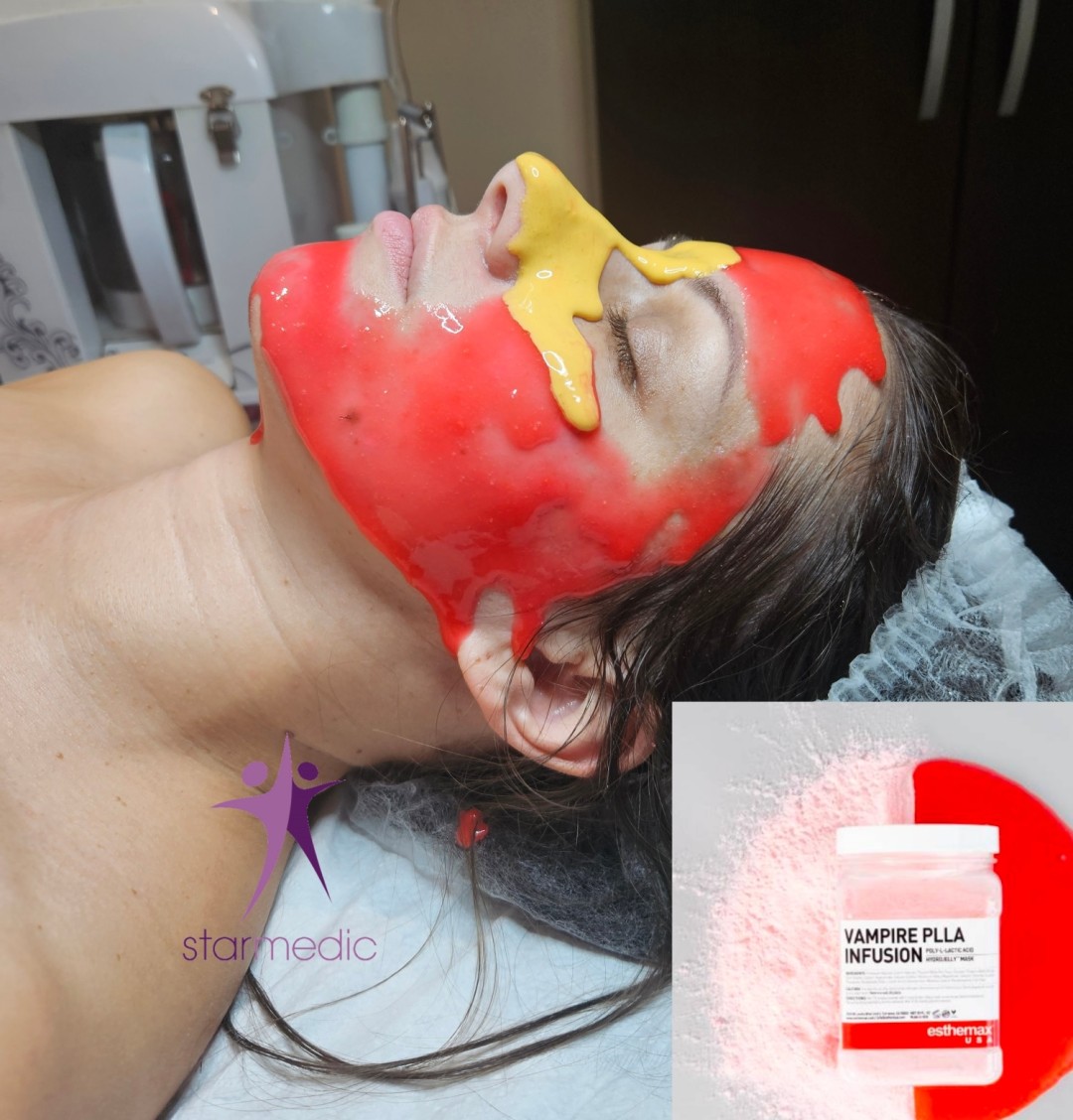 Starmedic #beograd Tretman lica Antiage tretman lica