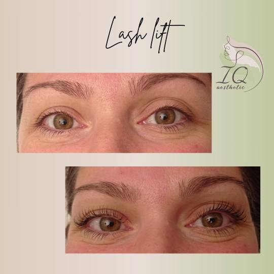 IQ aesthetic #beograd Trepavice Lash lift Lash lift rađen sa proizvodima koji dodatno jačaju trepa