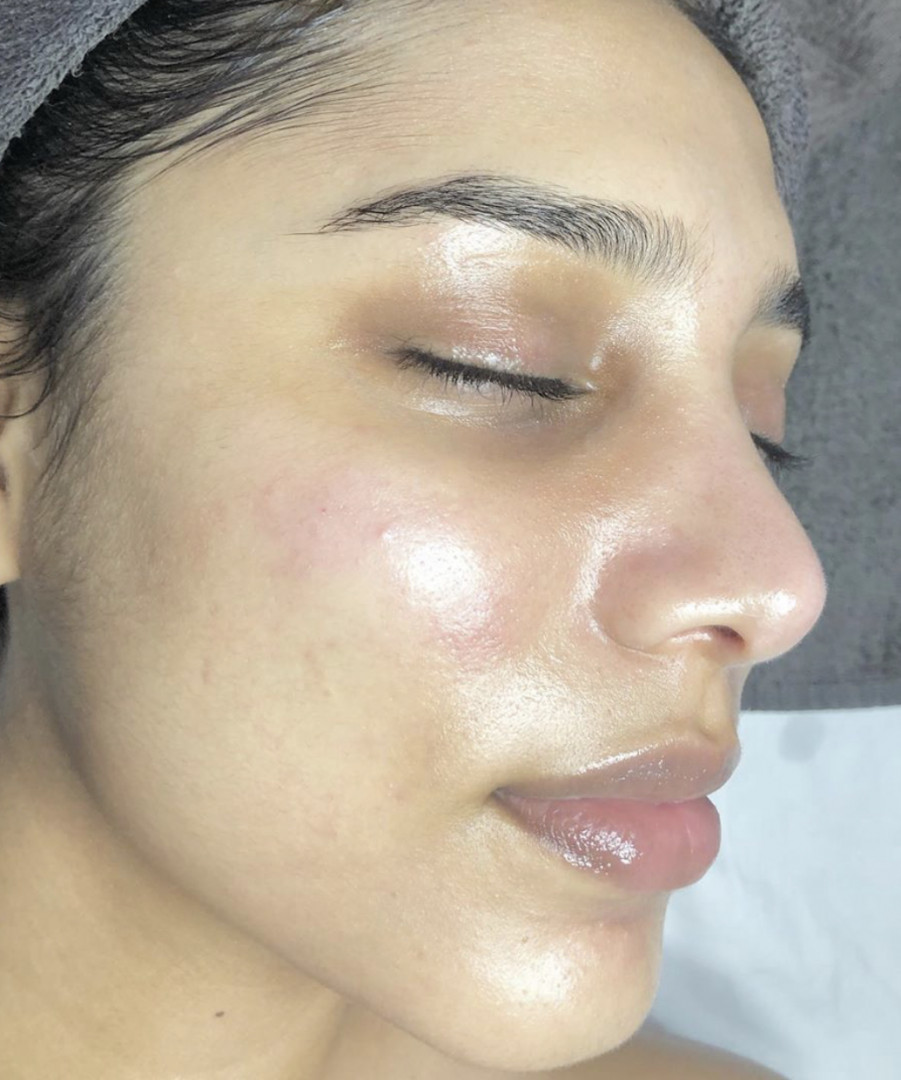 SkinLab Beauty Centar #novisad Tretman lica SKINLUX