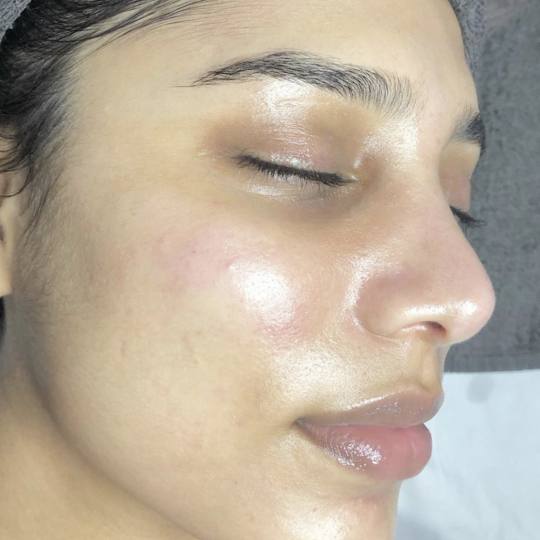 SkinLab Beauty Centar #novisad Tretman lica SKINLUX