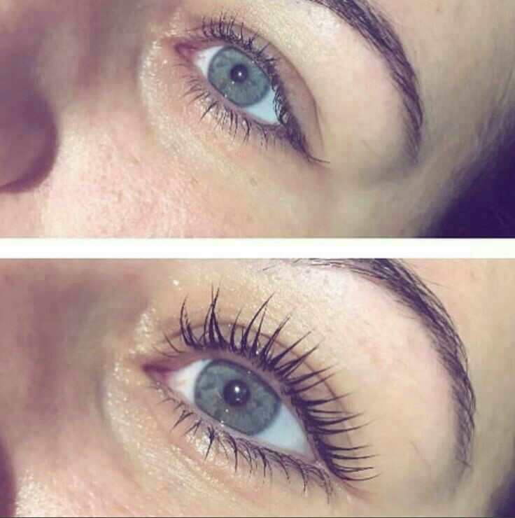 Lash lift + farbanje + Botox - Right Beauty, Beograd Trepavice Lice Trepavice, Beograd, Centar, Stari grad, Dorćol
