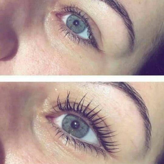 Right Beauty #beograd Trepavice Lash lift + farbanje + Botox