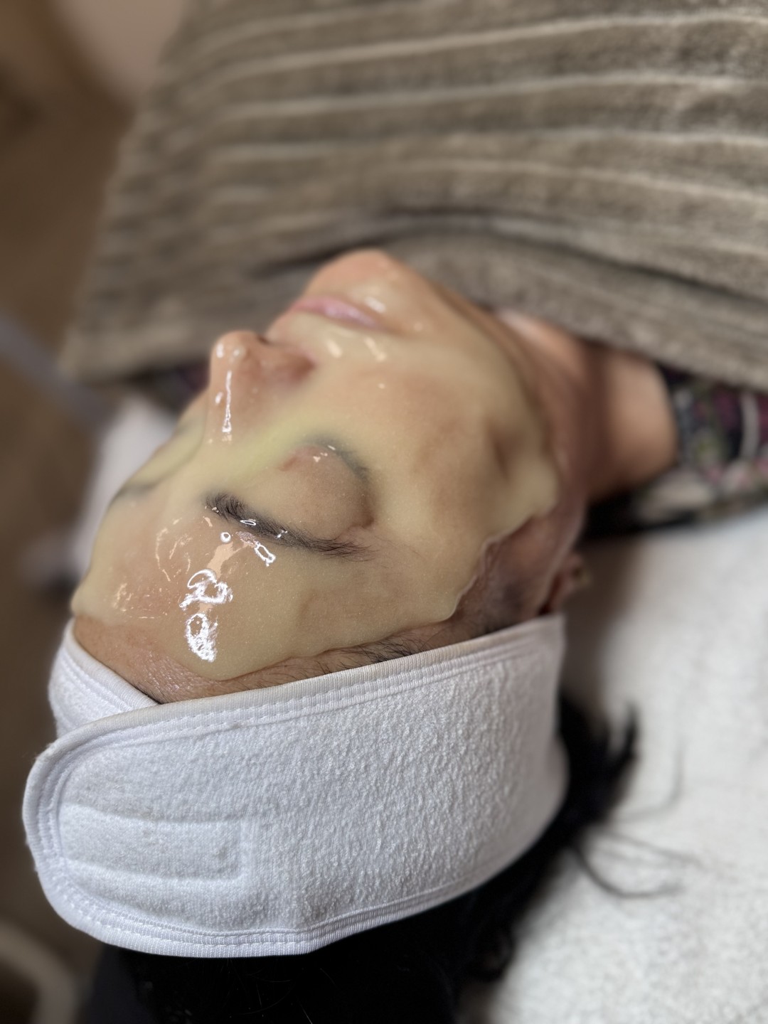 Step up beauty #beograd Tretman lica Mezoporacija lica - anti wrinkles
