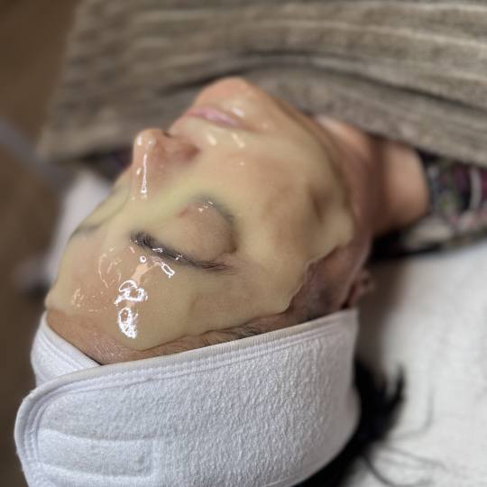 Step up beauty #beograd Tretman lica Mezoporacija lica - anti wrinkles